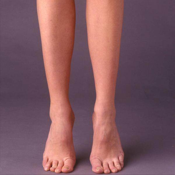 再談踮腳運動,也許你按我說的新方法做踮腳運動,你會更喜歡 再談踮腳運動,也許你按我說的新方法做踮腳運動,你會更喜歡