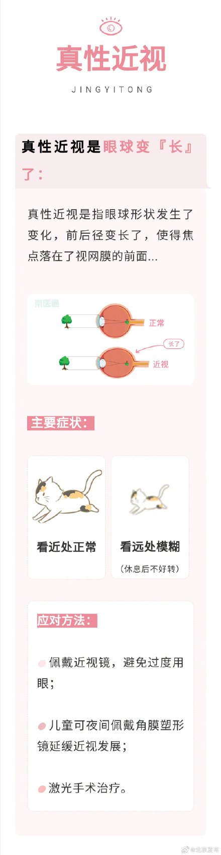 近視、散光、老花眼……到底有什麼不同，眼科醫生一句話告訴你