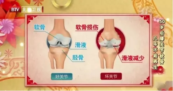 身體4個部位最怕&OpenCurlyDoubleQuote;硬&rdquo;，關節痛、心血管病，這份保養秘籍快收好