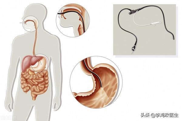 男子腹痛、面板黃，診斷膽管癌，妻子賣了房子治療後醫生：誤診了