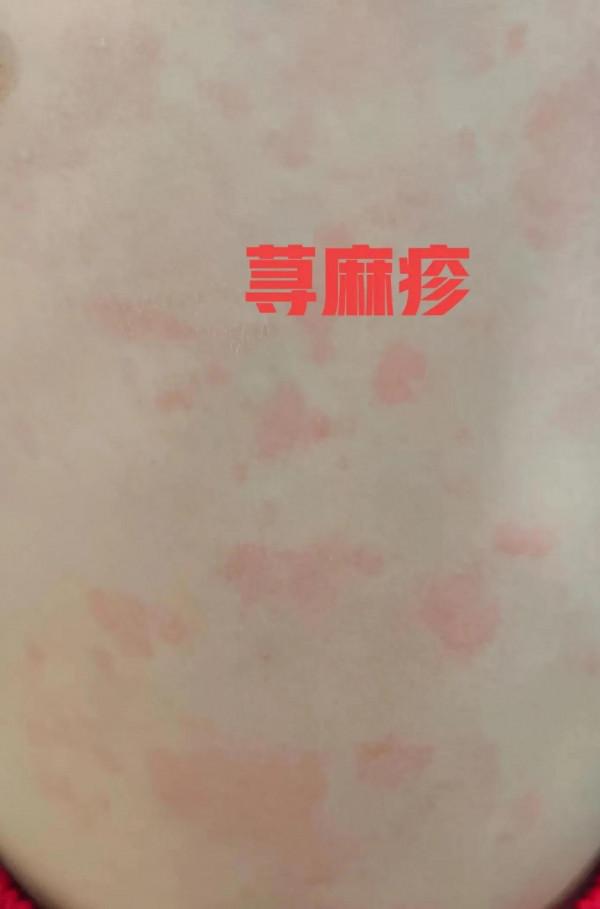 4種常見的面板病,教你最實用的識別和處理方法 4種常見的面板病,教你最實用的識別和處理方法