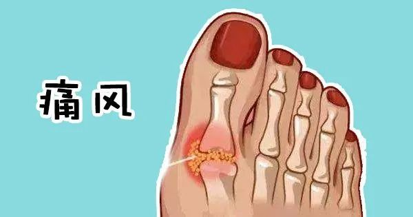 痛風不能吃豆製品,卻能以茶代水,怎麼回事?正解在這裡 痛風不能吃豆製品,卻能以茶代水,怎麼回事?正解在這裡