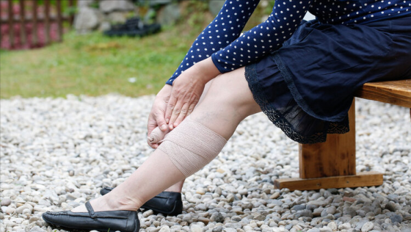 雙腿反映全身病，千萬要留意！腿上的5個疾病訊號，快來自查