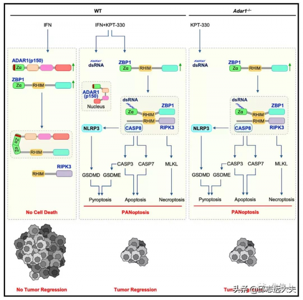 細胞死亡領域缺失的一塊拼圖:PANoptosis 細胞死亡領域缺失的一塊拼圖:PANoptosis