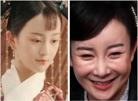 被整容毀了的7位明星，雖各有各的苦衷，卻都美麗盡失、事業滑坡