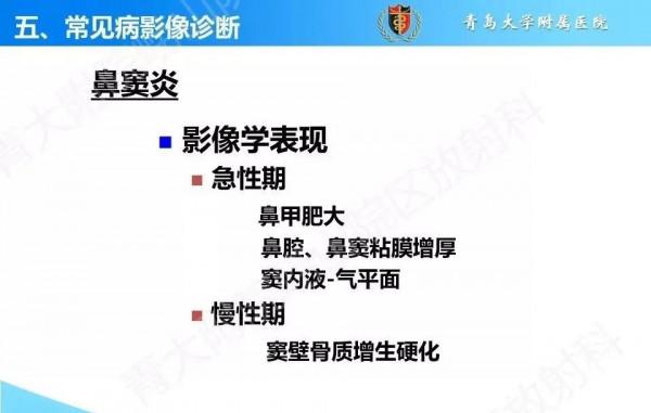 頭頸五官CT斷層解剖圖及常見病影像診斷