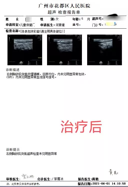 寶寶脖子總是歪著看向一邊,是正常的嗎? 寶寶脖子總是歪著看向一邊,是正常的嗎?