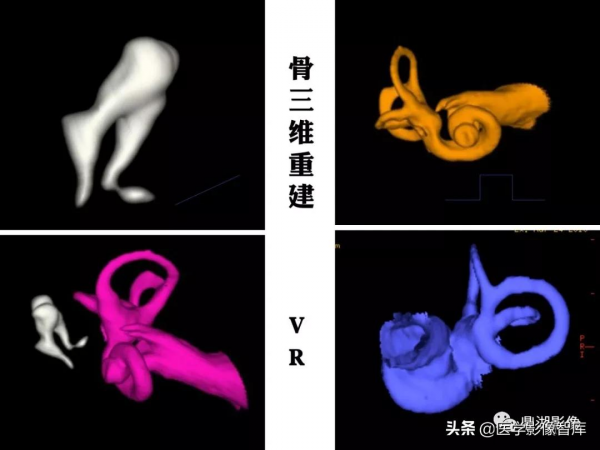 CT斷層解剖圖譜最全總結「推薦收藏」 CT斷層解剖圖譜最全總結「推薦收藏」