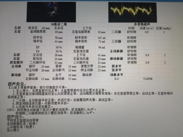 發作時胸悶背痛意識恍惚為哪般？……不一樣的心絞痛