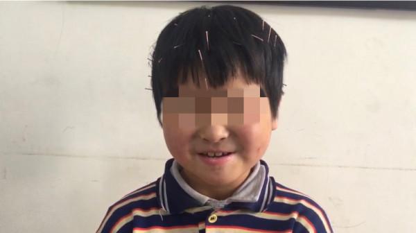 案例：9歲無發音、無語言的女孩，訓練後主動語言增多，對答如流