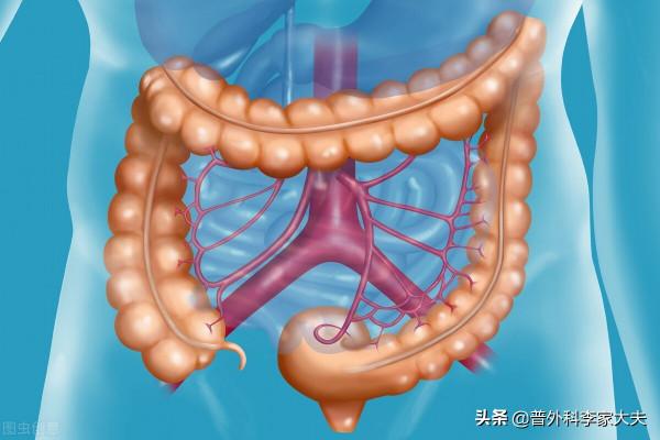 主任:為什麼未做腸鏡,你就知道患者是乙狀結腸癌? 主任:為什麼未做腸鏡,你就知道患者是乙狀結腸癌?