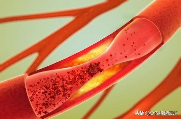 高血壓為什麼要吃葉酸？