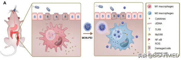 生物活性奈米材料透過清除多重危險分子治療炎症性腸病