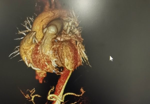 再現災難性疾病:閻王爺給了他一個月的時間,他卻錯過了 再現災難性疾病:閻王爺給了他一個月的時間,他卻錯過了