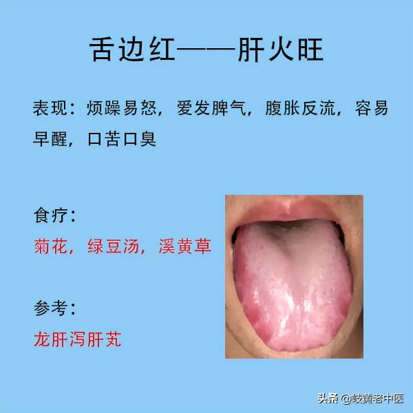 常見六種失眠的舌象，以及解決方法分享，這時候能睡個好覺了