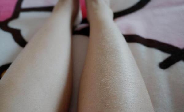 秋冬季節，每次脫褲子，腿上的白色皮屑是怎麼回事兒？