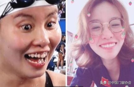 有種“整容”叫傅園慧，整牙後美到認不出，網友：相信baby沒撒謊