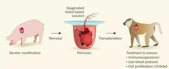 1984年,美國母親為給初生女兒續命,冒險移植狒狒心臟,最後怎樣了? 1984年,美國母親為給初生女兒續命,冒險移植狒狒心臟,最後怎樣了?
