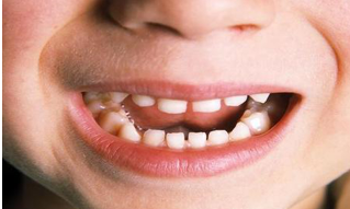 ​孫儷一招嚇得孩子乖乖刷牙，獲全網10w贊