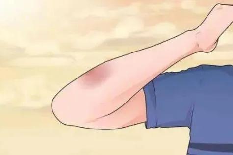 身體各部位的表現和可能缺乏的營養素對照整理！快來對照一下吧