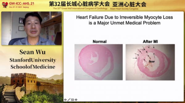 GW-ICC報道｜國際論壇：心血管細胞生物學最新研究進展