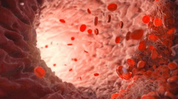 身體缺血有什麼表現? 身體缺血有什麼表現?