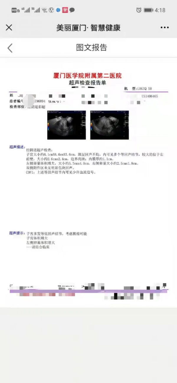 這個中藥:合歡花專治子宮肌瘤、囊腫、乳腺結節、疏肝解鬱效果好 這個中藥:合歡花專治子宮肌瘤、囊腫、乳腺結節、疏肝解鬱效果好