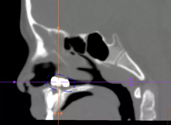 一份放射科醫師的值班日記，告訴你兒童意外傷害有多可怕