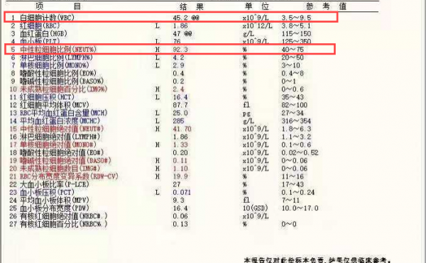 一例慢性中性粒細胞白血病病例分享