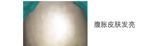 嬰兒餵養事件記錄（五）