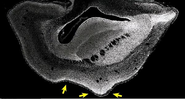人類專屬&OpenCurlyDoubleQuote;聰明基因&rdquo;被發現，難道我們真是被改造的？