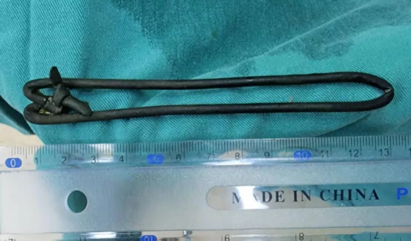 患者腹痛腹脹，市中心醫院普外科專家精準出手&OpenCurlyDoubleQuote;緝拿&rdquo;&OpenCurlyDoubleQuote;作怪&rdquo;元兇