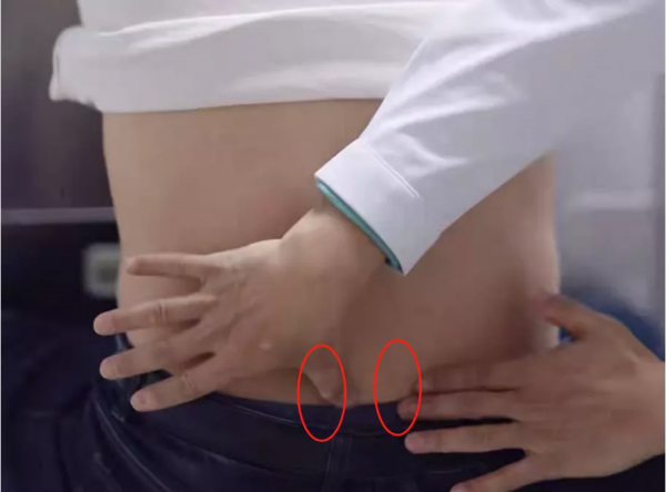 同是腰痛，敲擊感覺不同，引起原因大不同！（含後背部檢查方法）