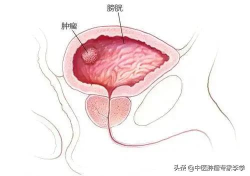 中醫是如何透過&OpenCurlyDoubleQuote;望、聞、問、切&rdquo;瞭解腫瘤患者病情的