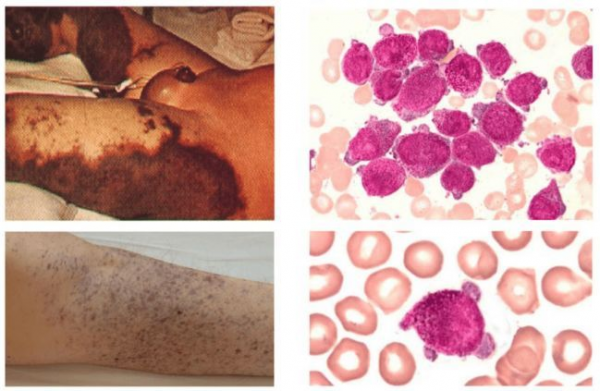 血常規的結果應該怎麼看？主要看3個指標，手把手教你看懂血常規