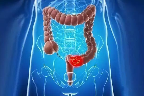 癌症真的會“遺傳”嗎？