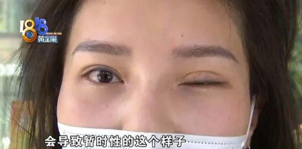 眼周抗衰,你還在打這種針? 眼周抗衰,你還在打這種針?