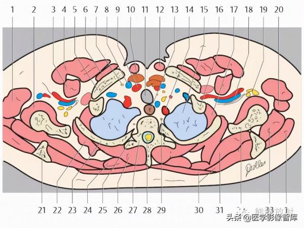 CT斷層解剖圖譜最全總結「推薦收藏」 CT斷層解剖圖譜最全總結「推薦收藏」