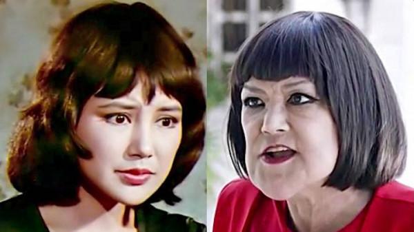 越整越難看後遺症一堆的9位女星！臉像鞋拔子，不敢做大表情