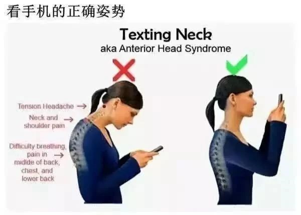讓手機摧殘頸椎的年輕人，別讓“頸椎病”拖垮你，快來看這裡