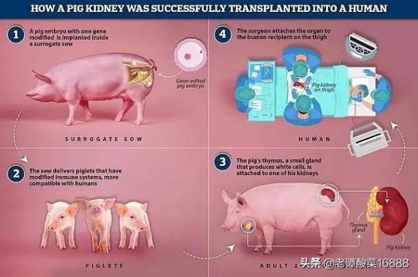 豬又有了突破性的功能，會否改變醫療資源格局