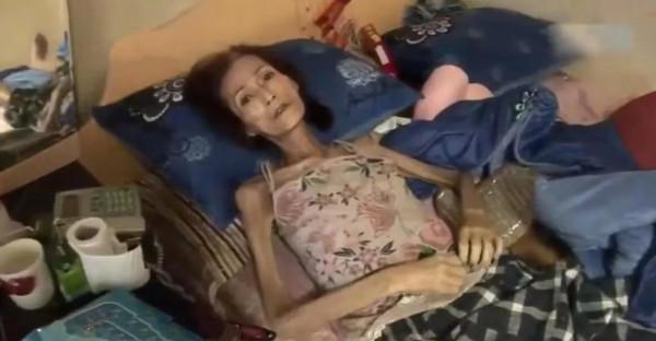 韓國女人瘦到皮包骨頭，生活無法自理，年輕時卻是大美人