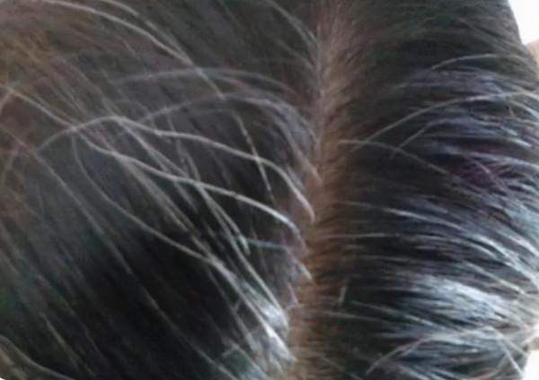 有了白髮先彆著急染髮，多吃這5種食物，或許能改善