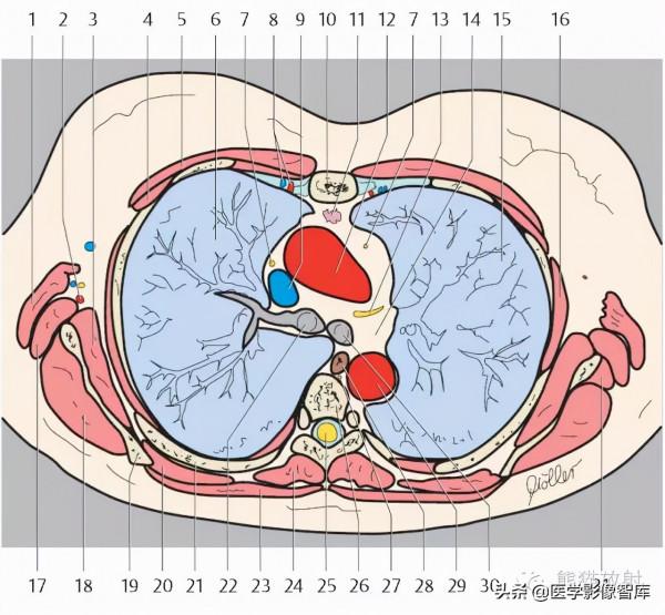 CT斷層解剖圖譜最全總結「推薦收藏」 CT斷層解剖圖譜最全總結「推薦收藏」