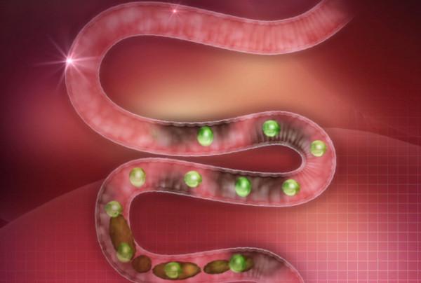 人體內真有6公斤宿便嗎？怎麼才能排出那些&OpenCurlyDoubleQuote;賴著不走&rdquo;的宿便？