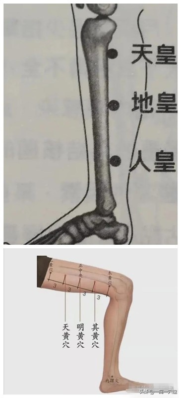 頑固性失眠你還在用藥物來調理，不妨試一下針灸方法，呼呼大睡