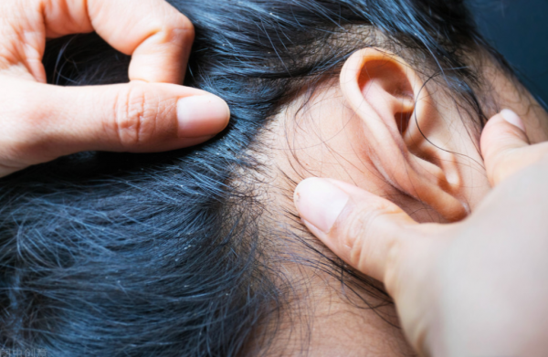 30年前，蟣子在男女老少人頭上很常見，為啥忽然間消失不見了？