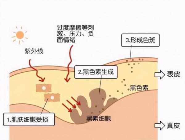 面膜多久敷一次才好?難怪護膚品不吸收,面板還是乾燥起皮 面膜多久敷一次才好?難怪護膚品不吸收,面板還是乾燥起皮