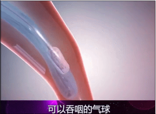 那些“網紅健身法”到底有多不靠譜？把我都給看笑了