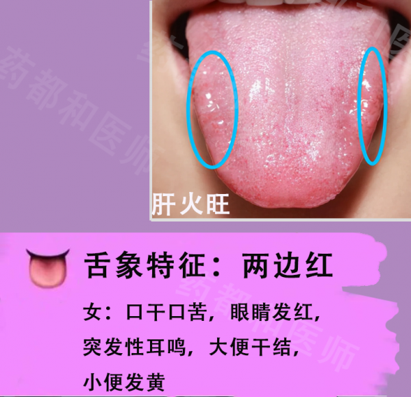 膽囊息肉,膽結石,肝囊腫?6種肝膽病變,看看舌象就知道 膽囊息肉,膽結石,肝囊腫?6種肝膽病變,看看舌象就知道